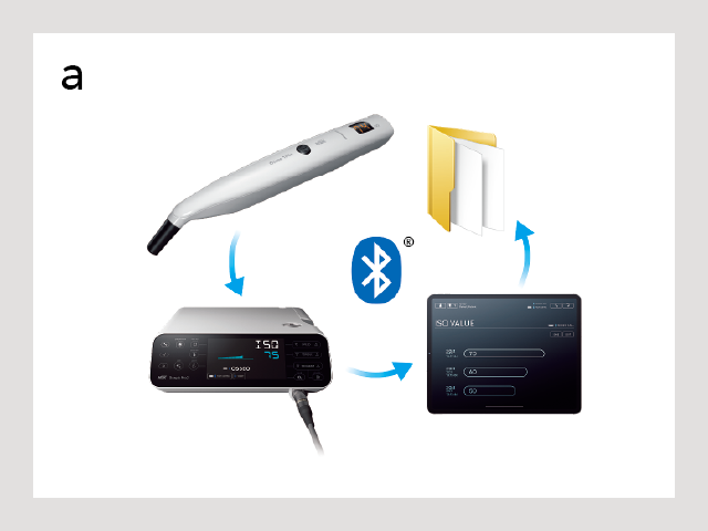 図5: a）Osseo100+にて測定したISQ値は、SurgicPro2を介して、iPadと接続することでデータ管理ができる。