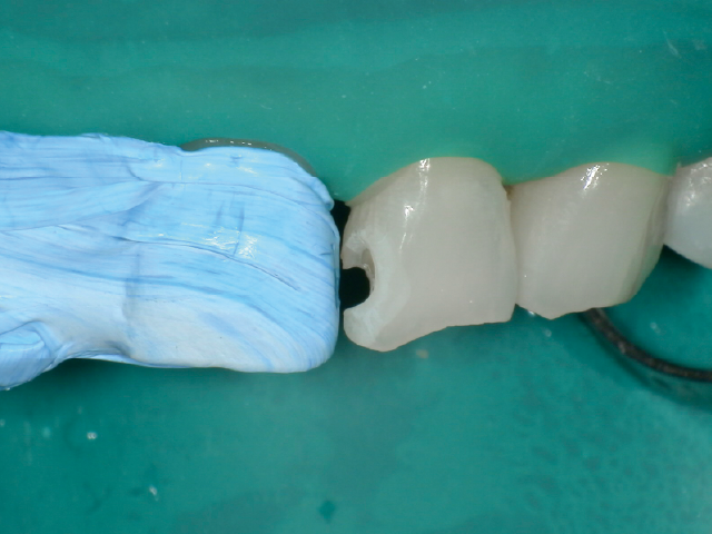 水洗・乾燥後。