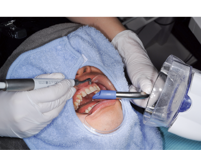 図2 : 噴射の向きを考慮して、飛散しないよう口腔外バキューム（株式会社東京技研）を配置。