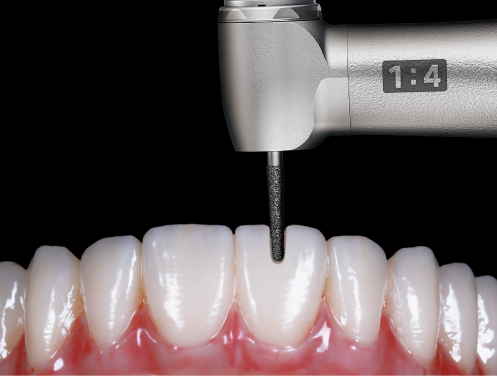 24%*向上したトルク