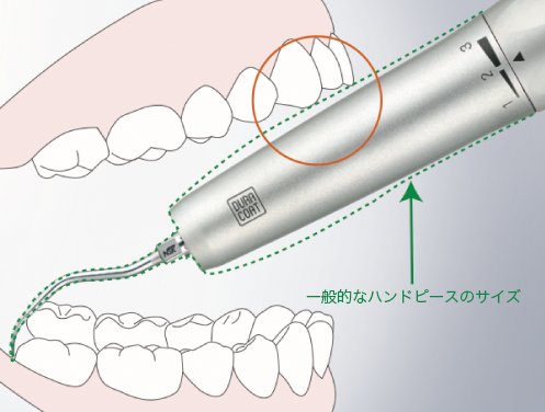 スリムボディ